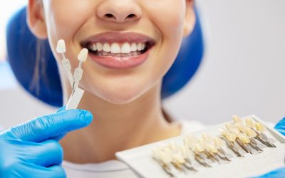 Understanding Porcelain Veneers in St. Johns, FL